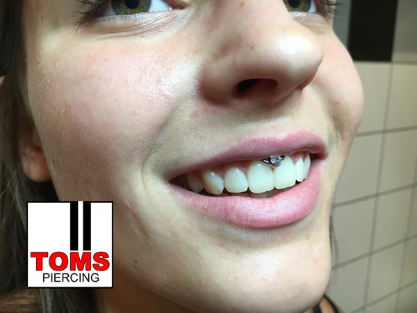 Smileypiercing3.jpg