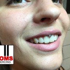 Smileypiercing3.jpg