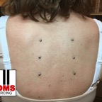 Microdermalpiercing24.jpg