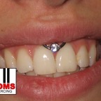 Smileypiercing2.jpg